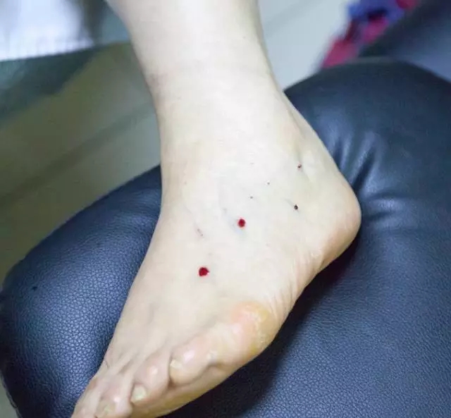 耳聋耳鸣患者部分治疗图