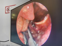 ��̿������ڼҿ�����ʲô����ȡ��