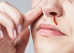 �Ͼ��ǳ�Ѫ�ĳ���ԭ������Щ��һ��